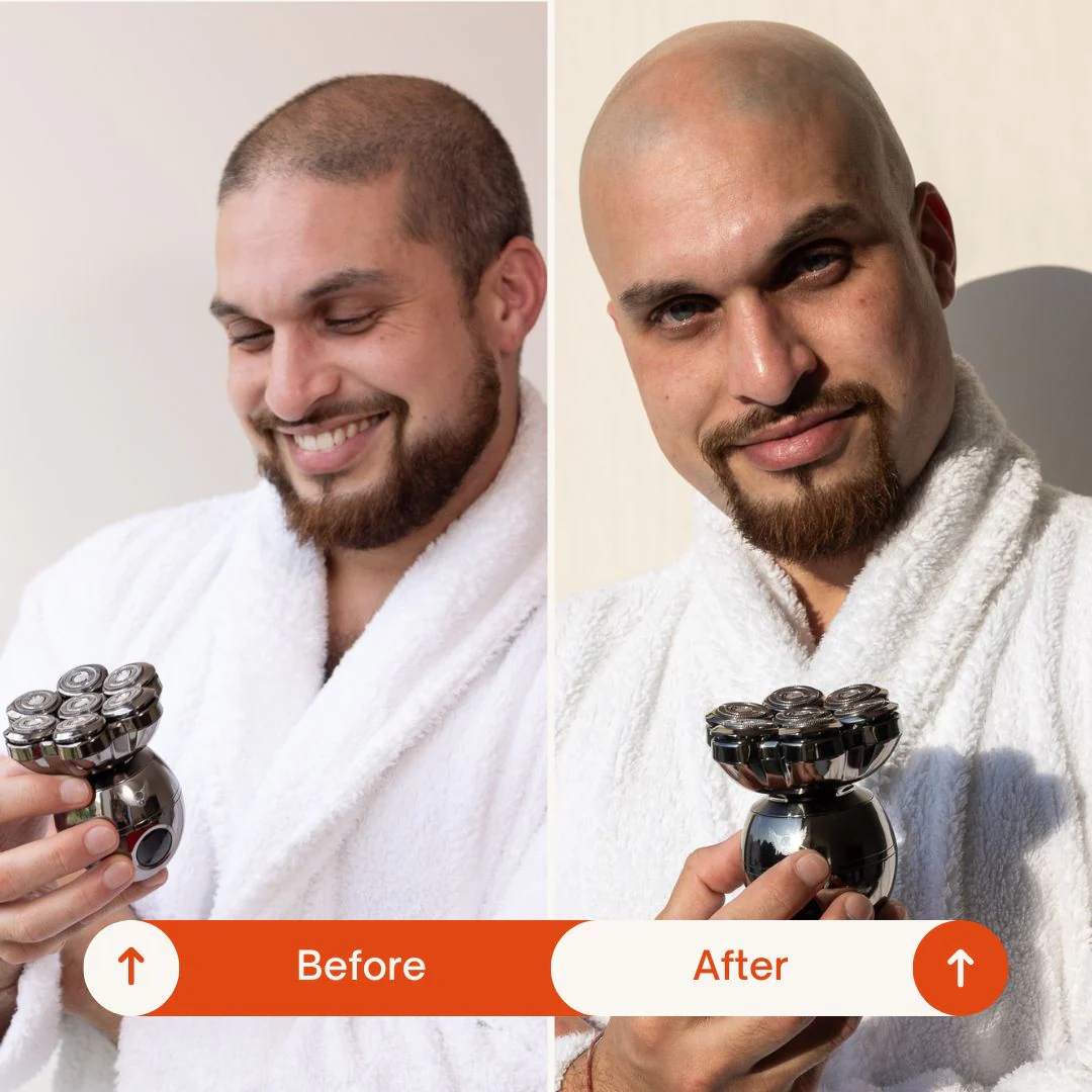 Trimpod 3.0: The Ultimate Shaver for Bald Men - Image 5
