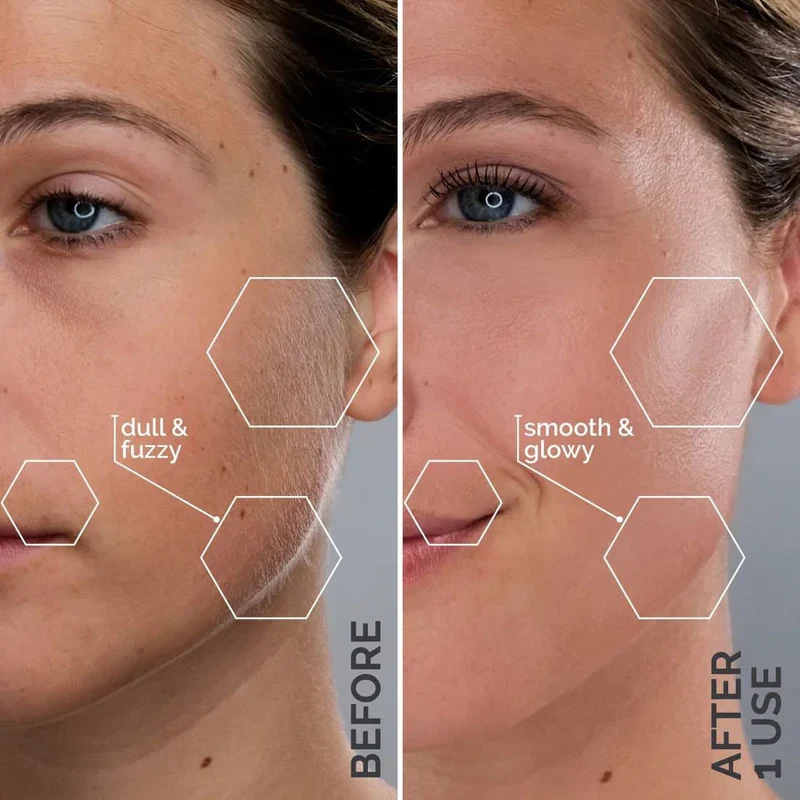 Trim Pod 3.0  : The Best Dermaplaning Tool For Women Over 40 - Image 3